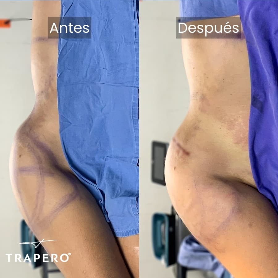 cirujano plastico para implantes de cadera