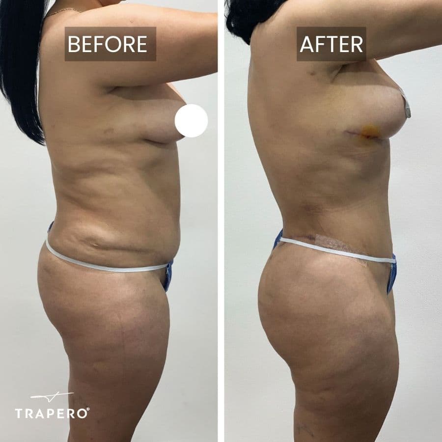 mommy makeover surgeon